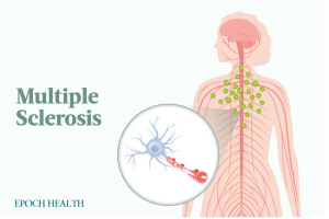 The Essential Guide to Multiple Sclerosis: Symptoms, Causes, Treatments, and Natural Approaches